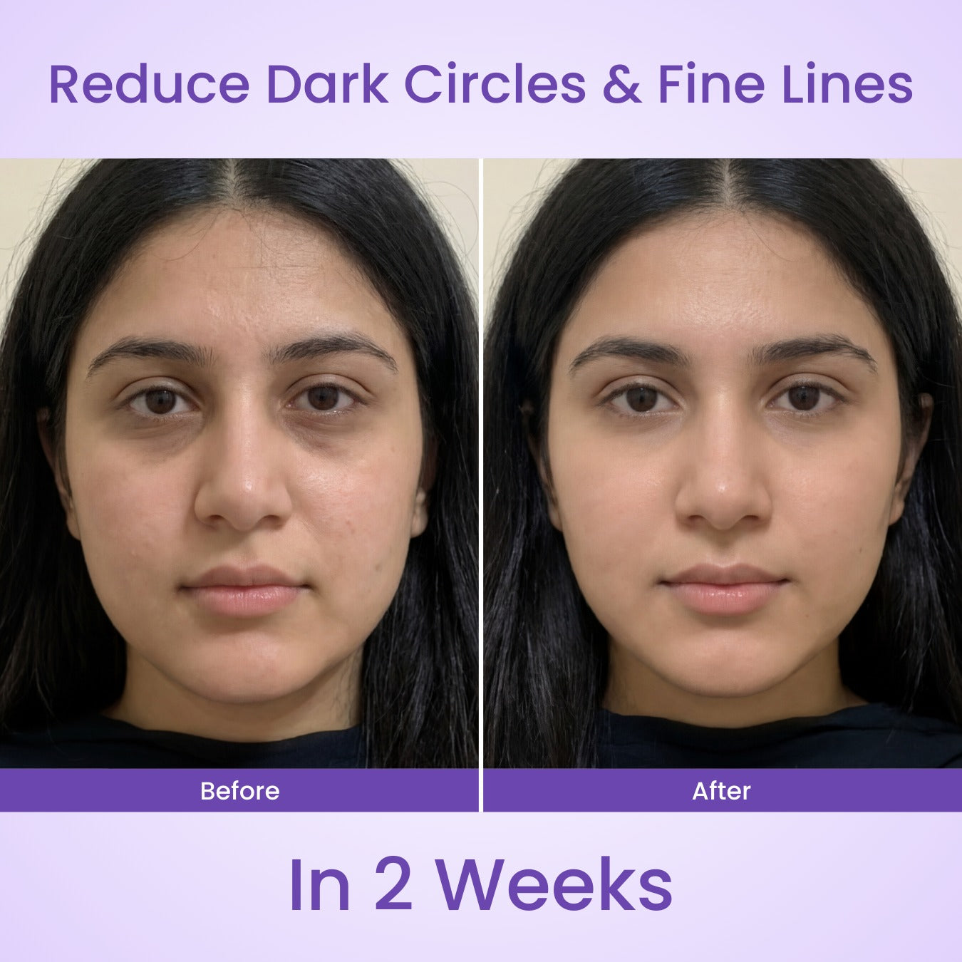 Lyvon™ Facial Wand pen