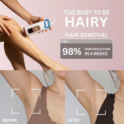 Lyvon™ Hair Removal SilkIce