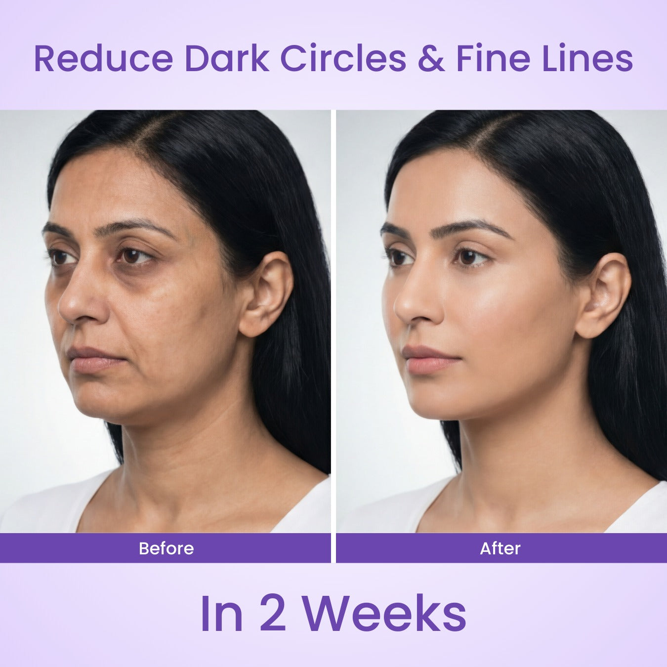 Lyvon™ Facial Wand pen