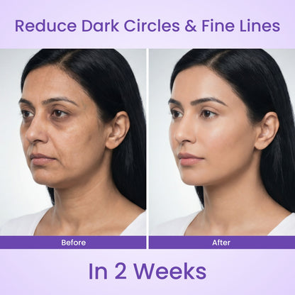 Lyvon™ Facial Wand pen