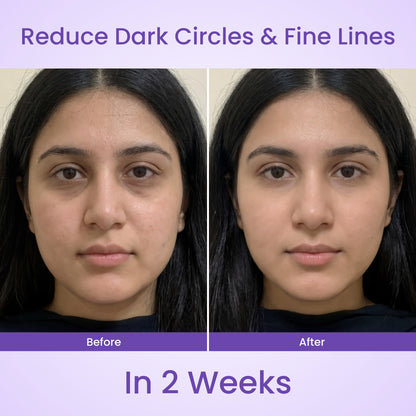 Lyvon™ Facial Wand pen